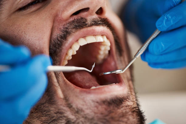 Best Broken or Cracked Tooth Emergency Dentist in Regency At Monroe, NJ
