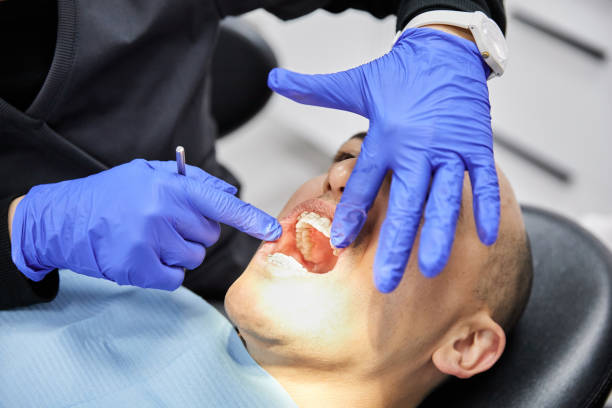 Best Emergency Dentist for Lost Fillings or Crowns in Regency At Monroe, NJ