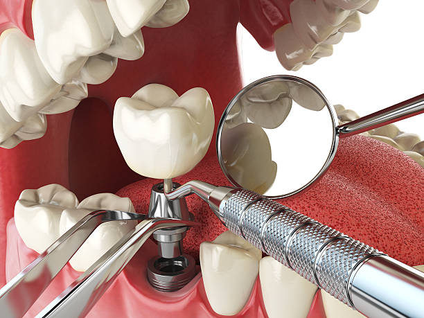 Best Emergency Root Canal Treatment in Regency At Monroe, NJ